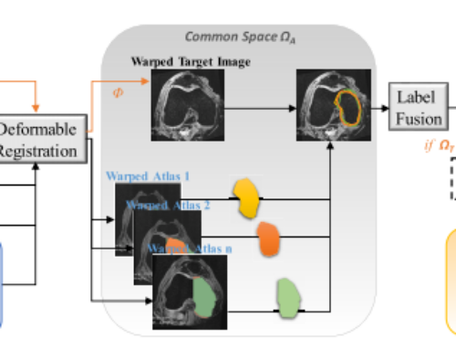 Personalized Knee Geometry Modelling based on Multi-Atlas Segmentation and Mesh Refinement  —  IEEE Access, December 2020