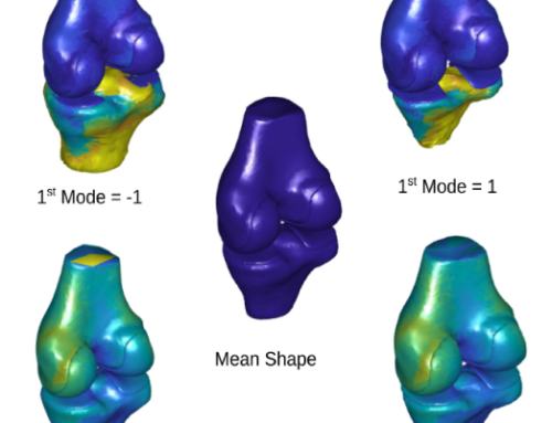 Regularized Multi-Structural Shape Modeling of the Knee Complex based on Deep Functional Maps  —  Computerized Medical Imaging and Graphics, April 2021