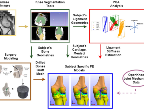 Evaluation of anterior cruciate ligament surgical reconstruction through finite element analysis —  Scientific Reports 12, May 2022