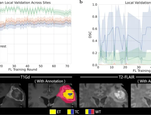Federated learning enables big data for rare cancer boundary detection —  Nature Communications 13, December 2022